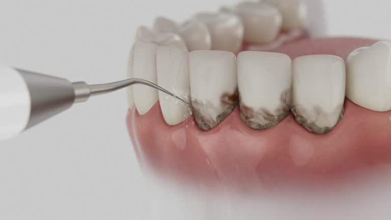 Trusted Tooth Extraction service in Bartonville, TX - Dentist Open Now